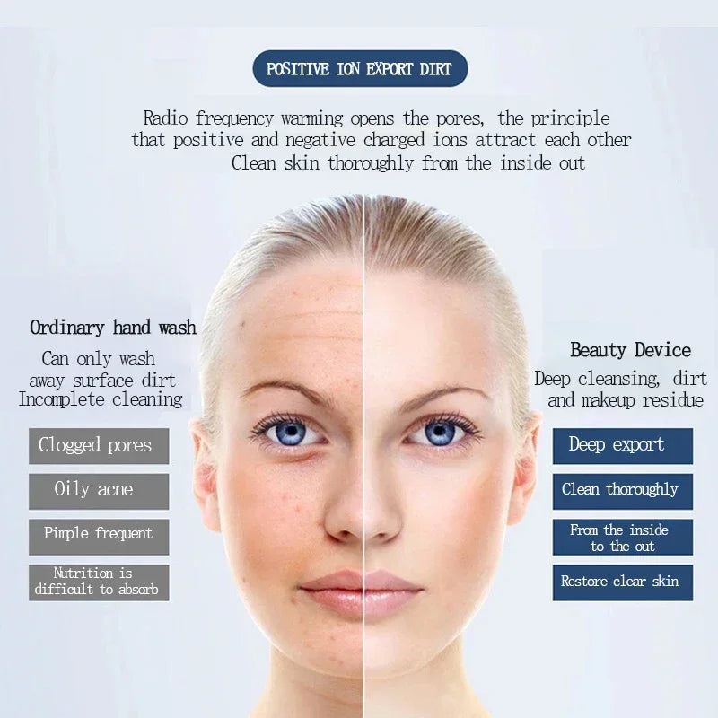 Ultrasonic Ionic Facial Skin Tightening and Cleaning Device - 6