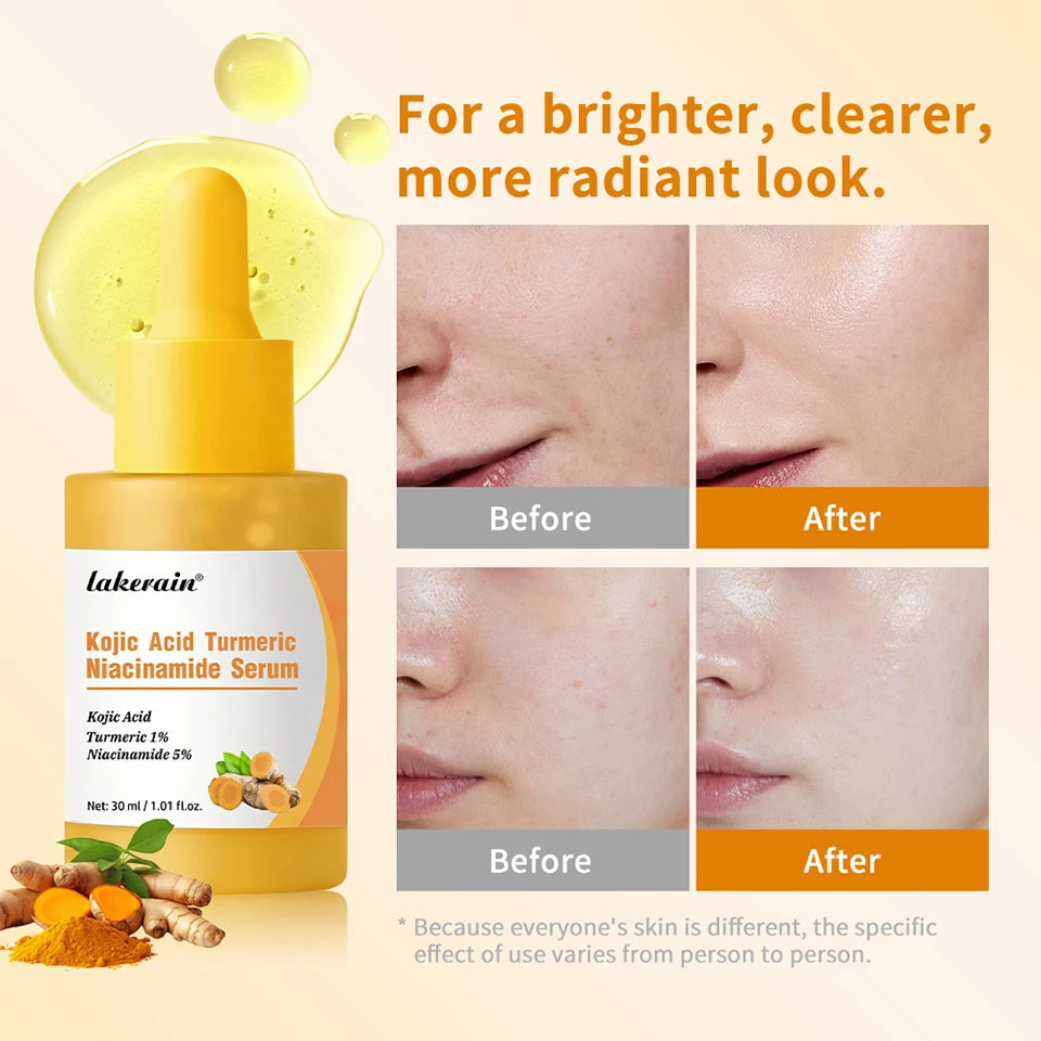 Brightening Kojic Acid and Turmeric Face Serum - 11