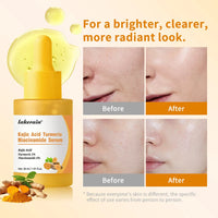 Brightening Kojic Acid and Turmeric Face Serum