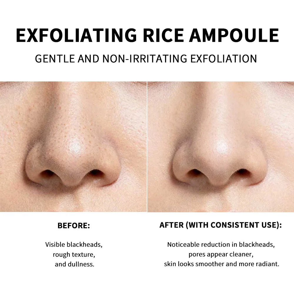 Exfoliating Rice Essence for Radiant and Smooth Skin - 5