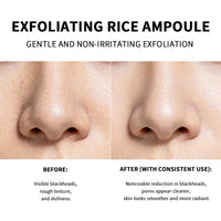 Exfoliating Rice Essence for Radiant and Smooth Skin
