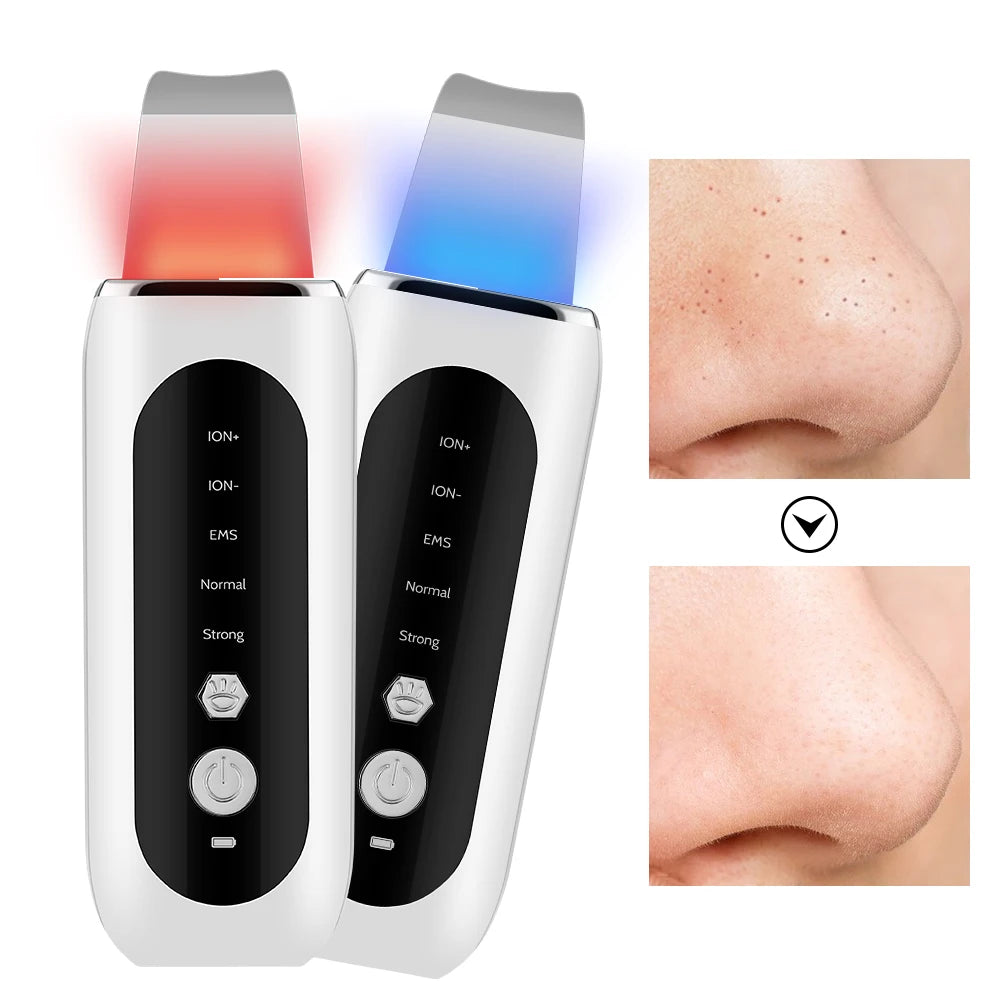 Ultrasonic Facial Skin Scrubber and Pore Cleanser - 1