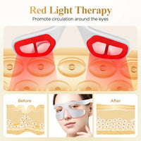 3D Red Light Therapy Eye Massager for Fatigue and Dark Circles