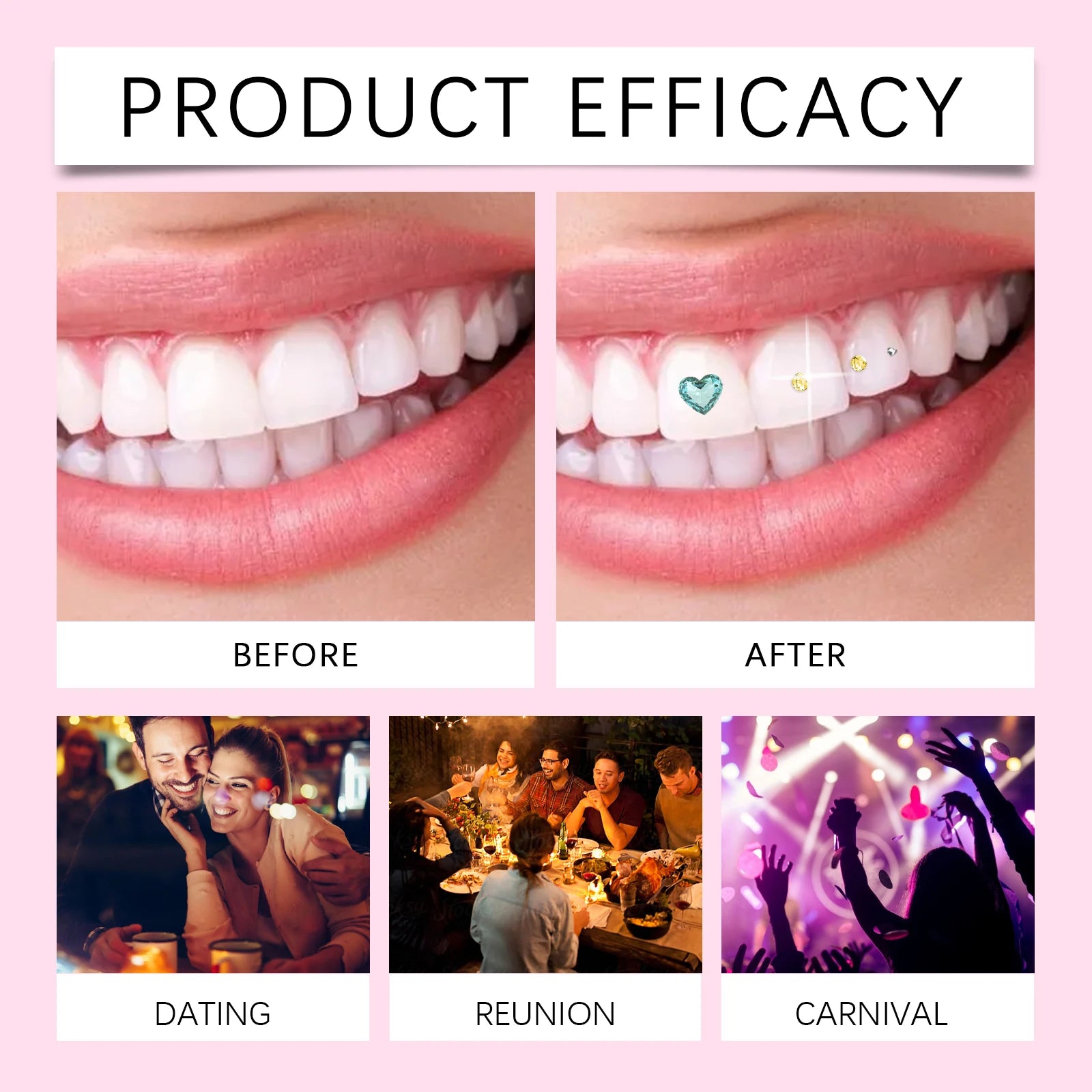 Professional DIY Tooth Gem Kit for Dazzling Smile - 6
