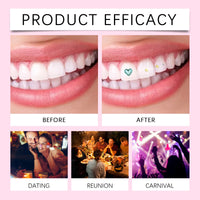 Professional DIY Tooth Gem Kit for Dazzling Smile