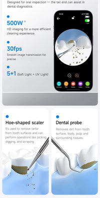 Visible Ultrasonic Teeth Whitening & Plaque Remover