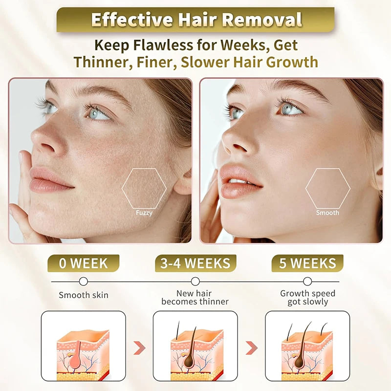 Electric Threading Epilator for Painless Facial Hair Removal - 26