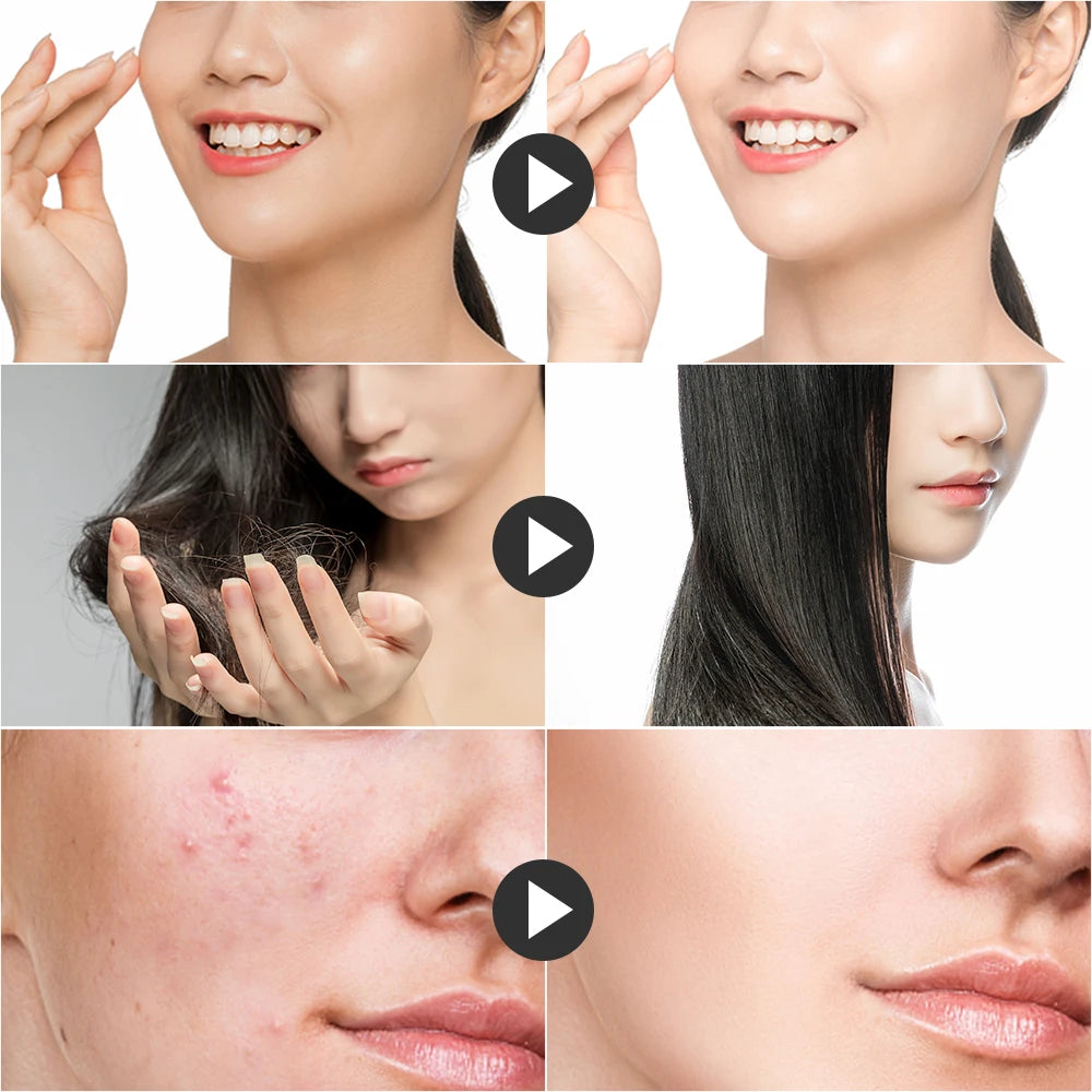 4-in-1 High-Frequency Facial Wand for Acne and Anti-Aging - 15