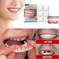 Comfort Fit Cosmetic Smile Veneers