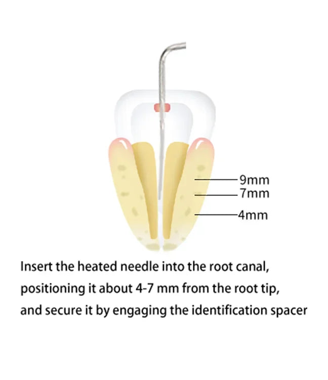Wireless Dental Gutta-Percha Obturation System - 11