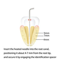 Wireless Dental Gutta-Percha Obturation System