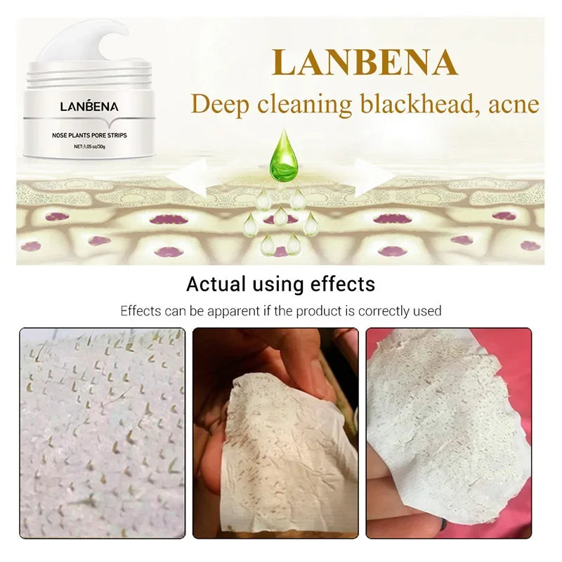 Deep Cleaning Nose Pore Strip Mask for Blackhead Removal - 20