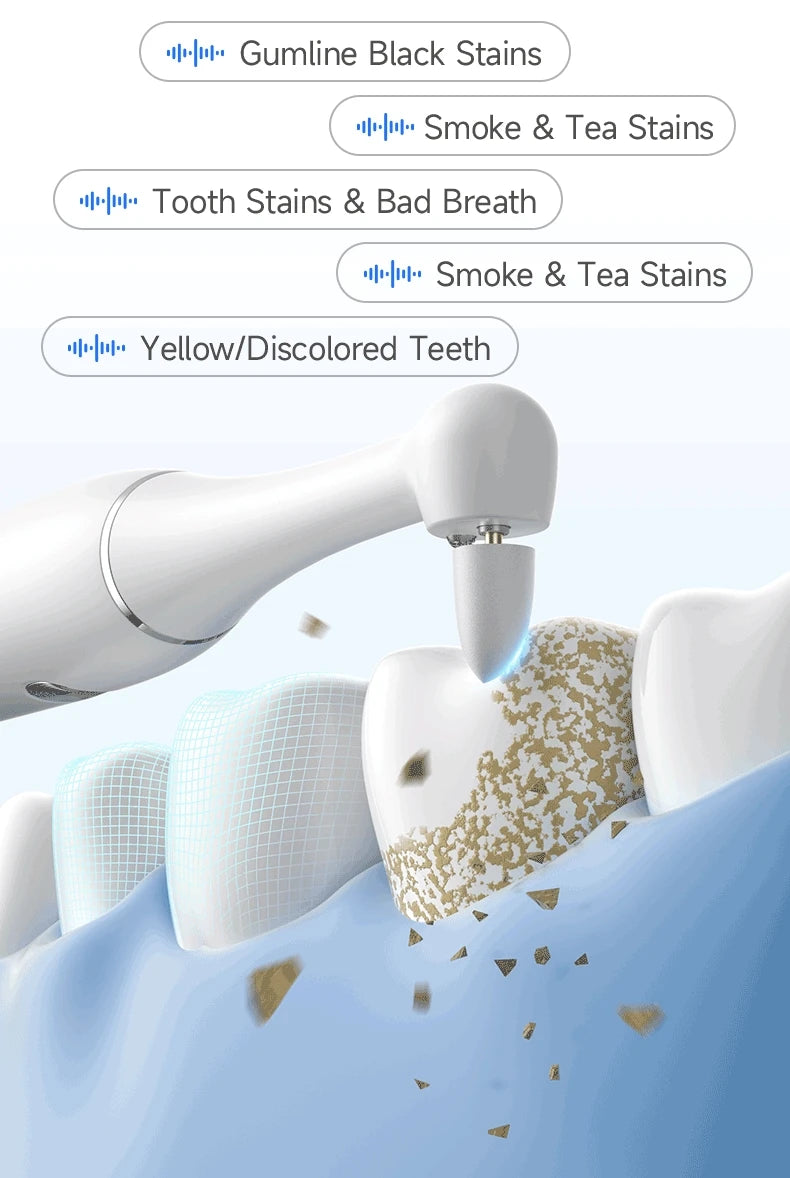 Electric Ultrasonic Teeth Whitening and Tartar Remover Kit - 11