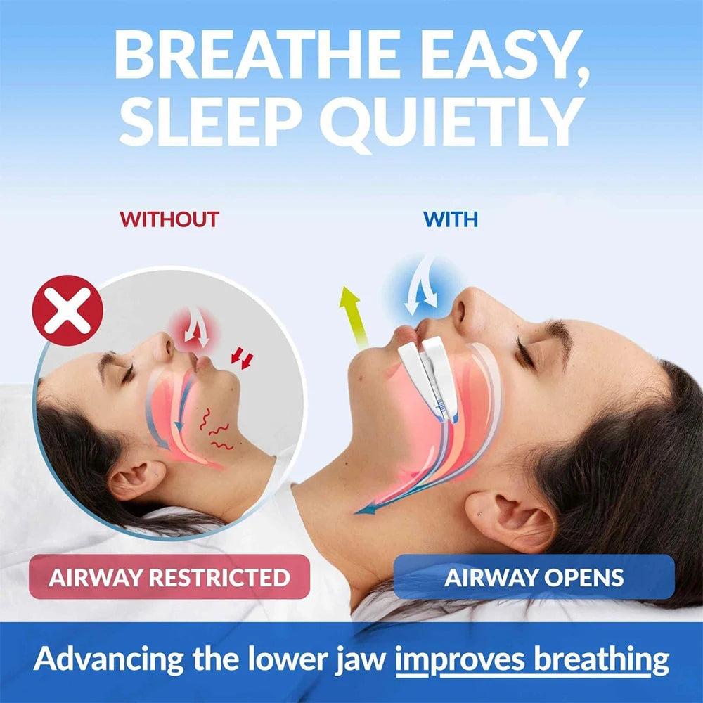 Adjustable Anti-Snoring Sleep Mouthpiece - 2