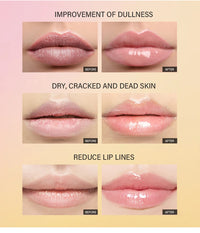 Peptide Moisturizing Lip Treatment Gel