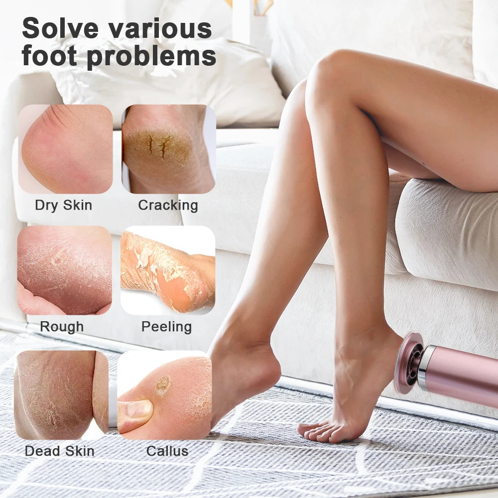Electric Professional Pedicure Foot Callus Remover - 11