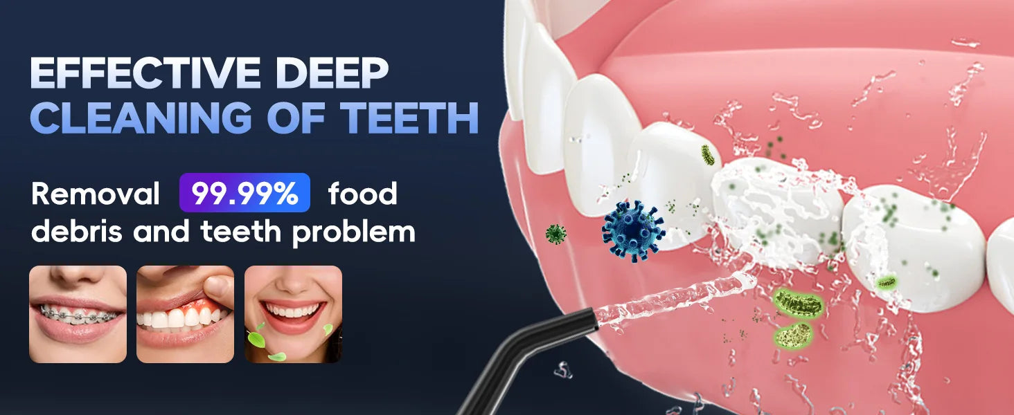 Portable Cordless Water Flosser for Deep Teeth & Gum Cleaning - 8