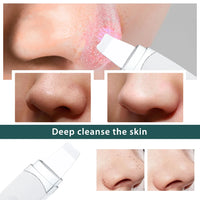 Ultrasonic Facial Skin Scrubber and Pore Cleaner