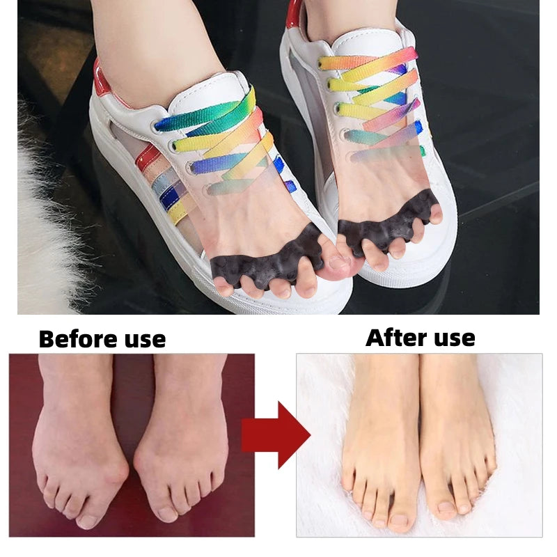 Orthopedic Gel Toe Separator and Bunion Corrector - 8
