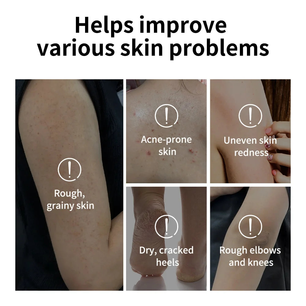 Glycolic Acid Exfoliating Body Treatment Stick - 5
