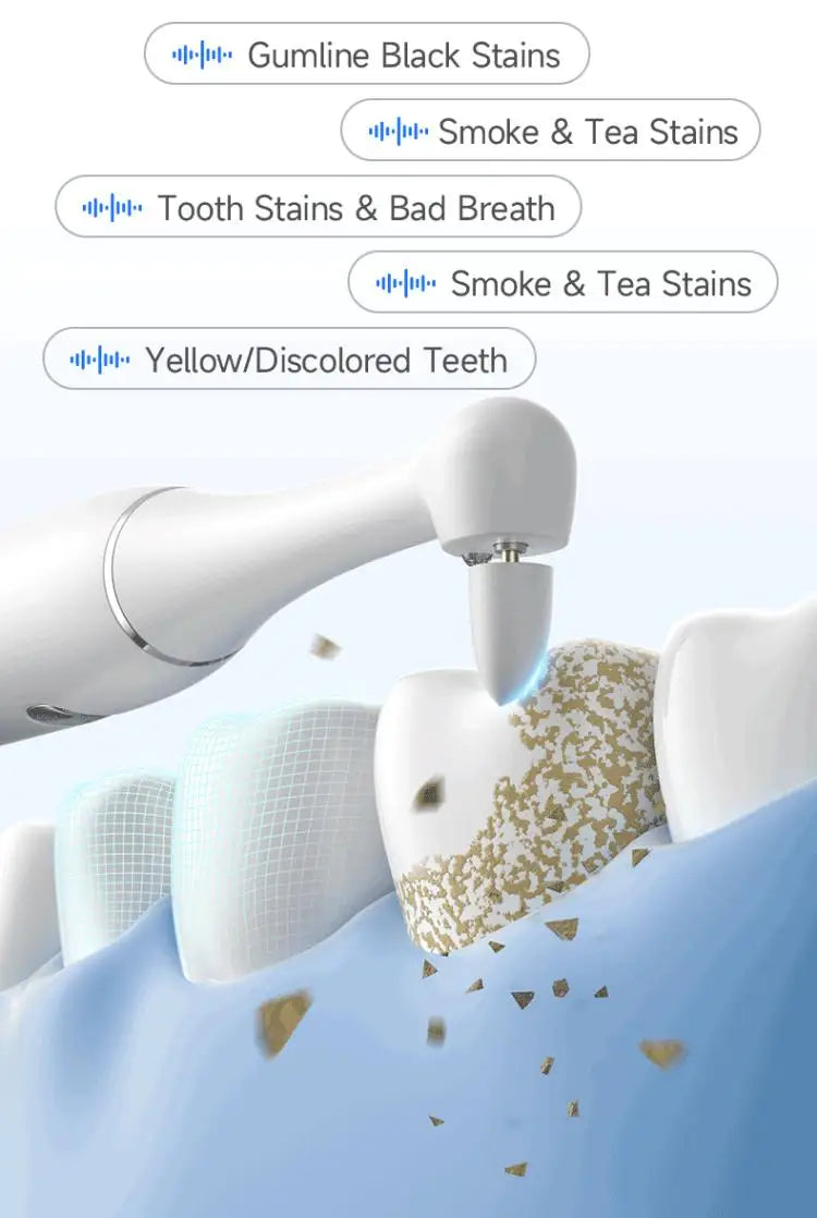 Electric Ultrasonic Teeth Whitening and Tartar Remover Kit - 10