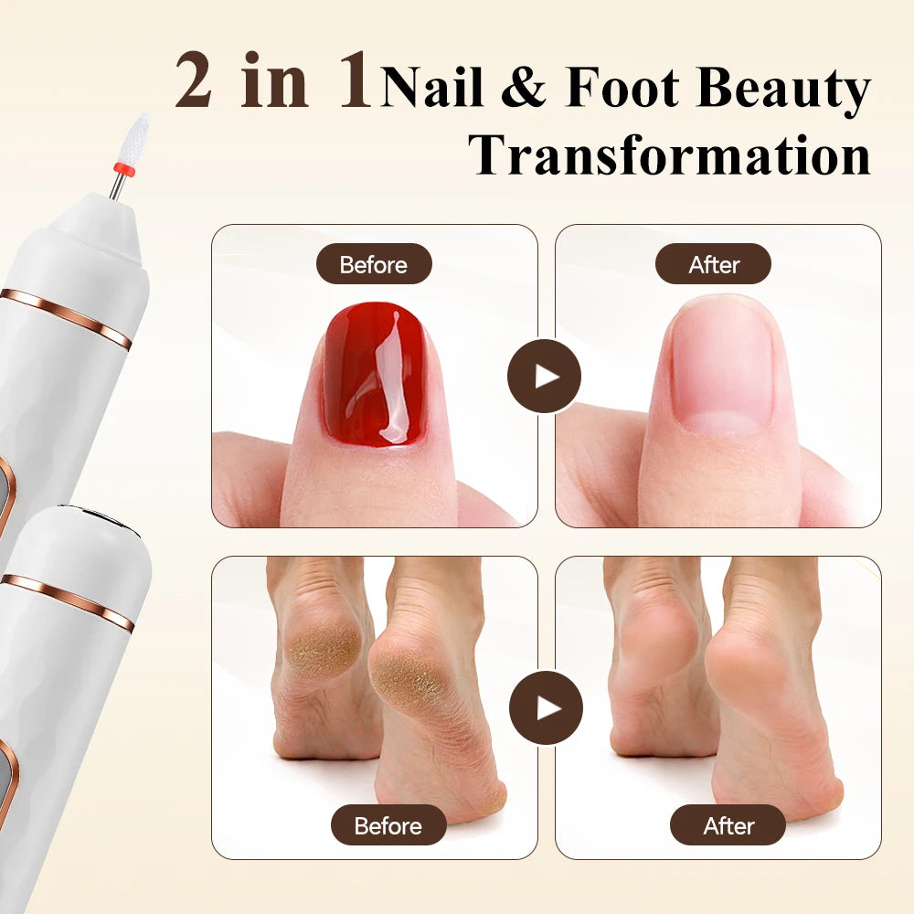 2-in-1 Electric Callus Remover and Nail Polishing Kit - 5