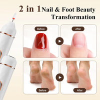 2-in-1 Electric Callus Remover and Nail Polishing Kit