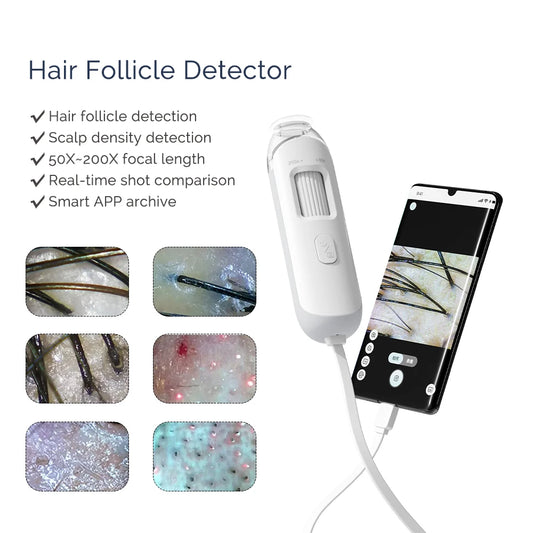 Portable HD Hair Follicle and Scalp Health Analyzer