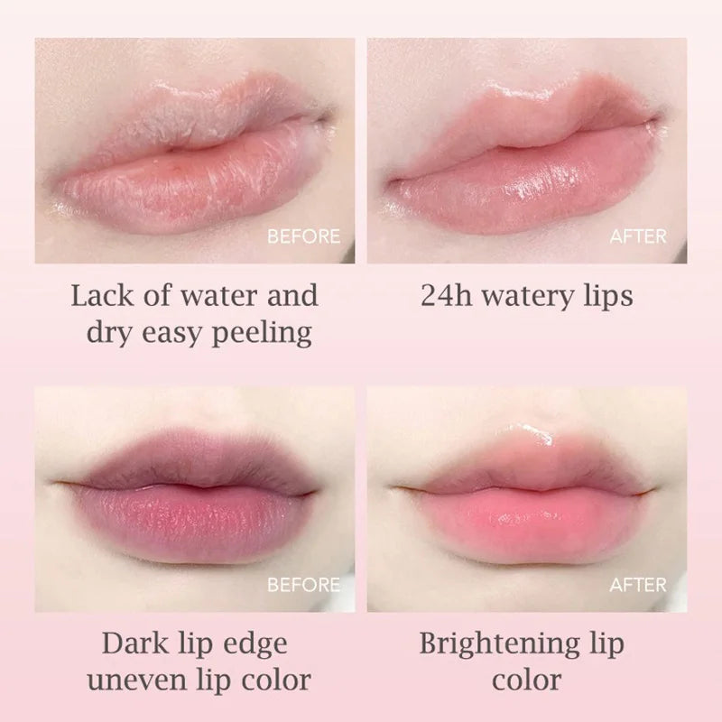Fruit-Infused Hydrating Lip Balm Set - 6