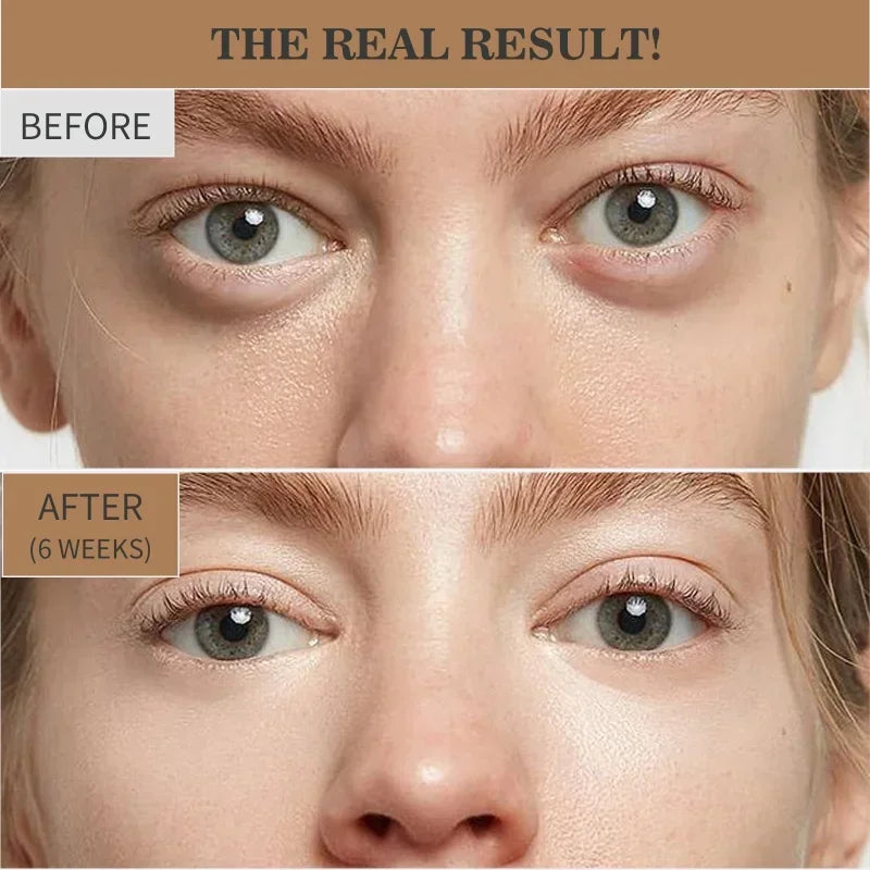 Retinol Eye Cream for Wrinkles and Dark Circles - 2