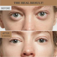 Retinol Eye Cream for Wrinkles and Dark Circles