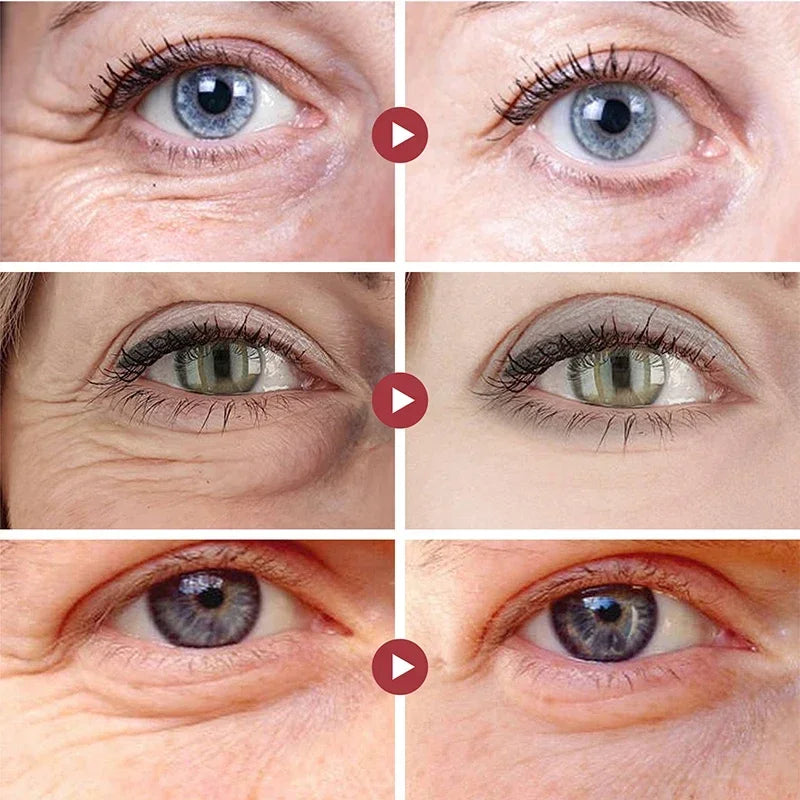 Retinol Anti-Aging Eye Balm for Dark Circles and Puffiness - 4