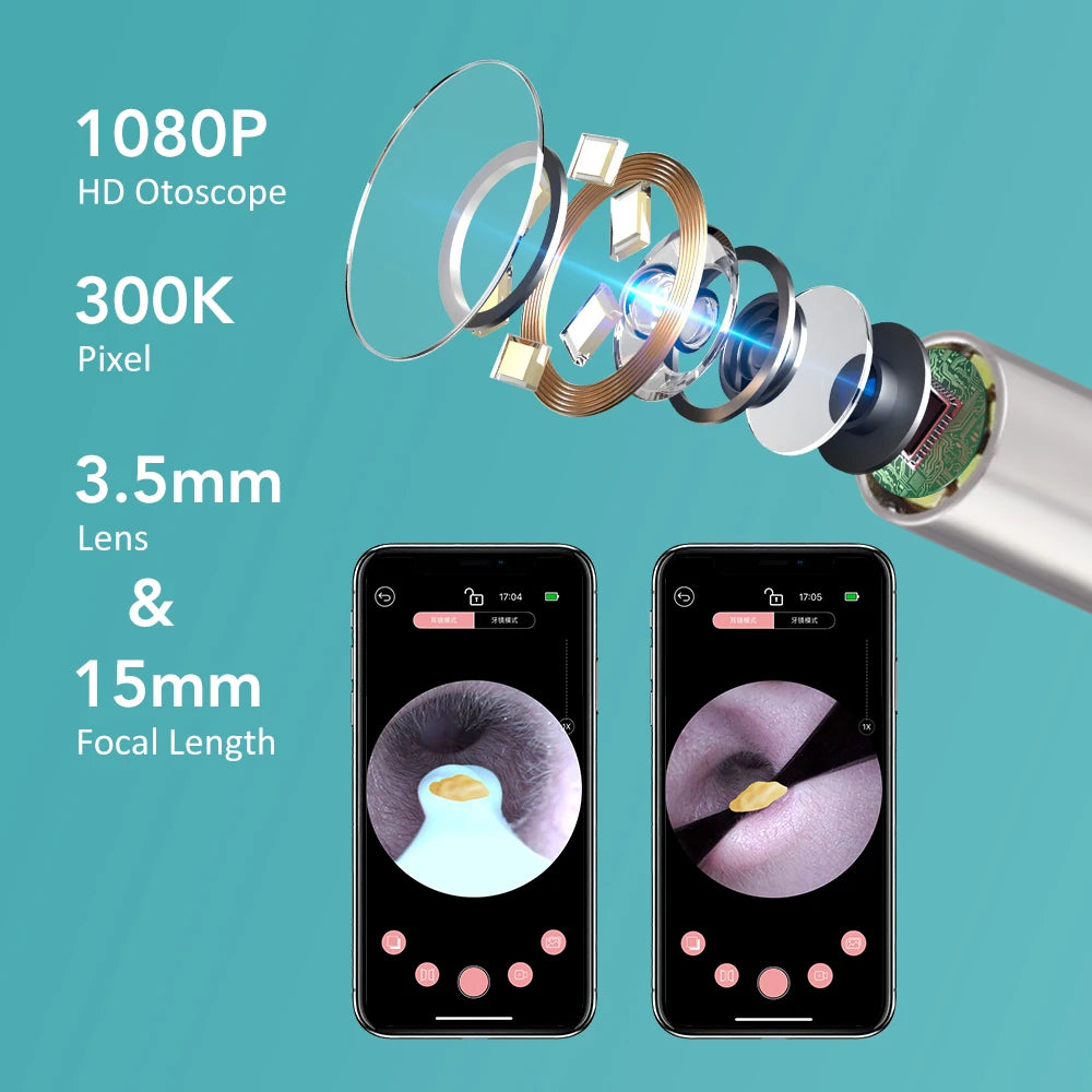 HD Visual Earwax Removal Tool with Camera - 2