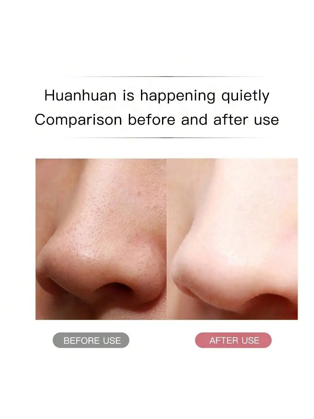 Ultrasonic Facial Skin Scrubber for Deep Pore Cleansing - 4