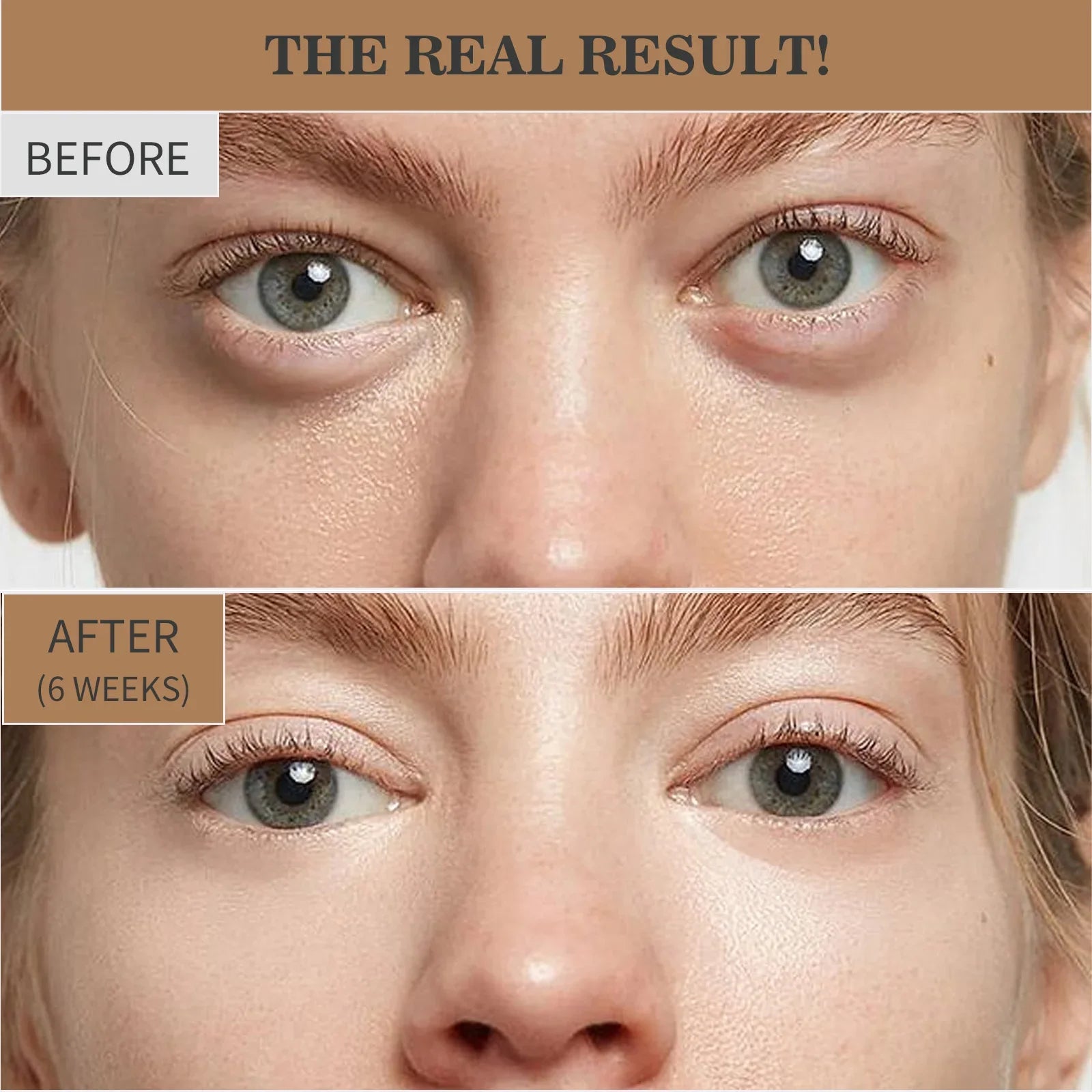 Retinol Eye Cream for Wrinkles and Dark Circles - 8