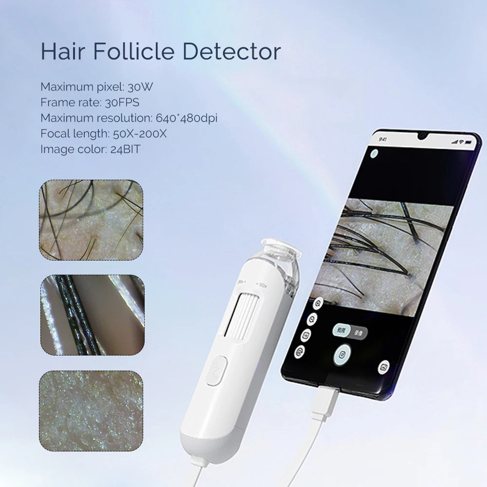 Portable HD Hair Follicle and Scalp Health Analyzer - 15