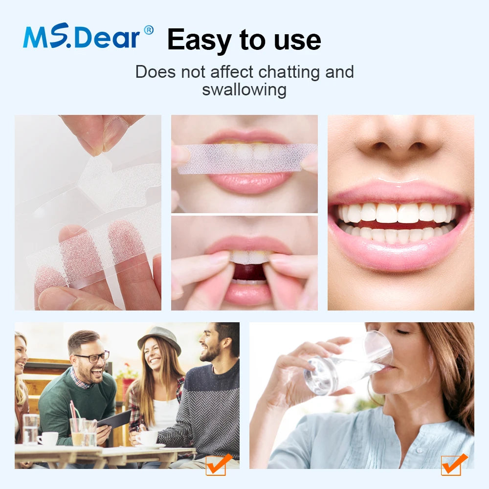 Ultrasonic Teeth Cleaner and Whitening Kit - 21