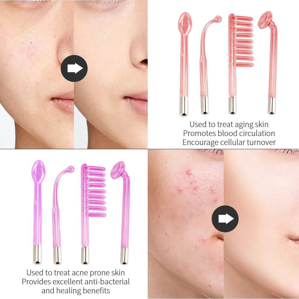 4-in-1 High-Frequency Facial Wand for Acne and Anti-Aging - 2