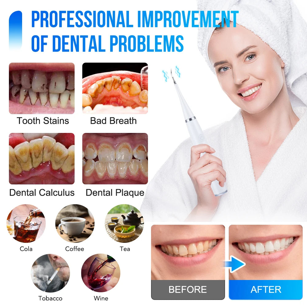 Electric Sonic Dental Scaler and Teeth Whitening Kit - 3
