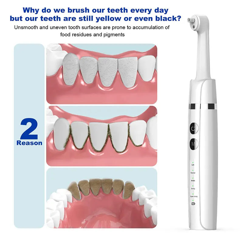 Electric Tooth Polisher for Home Teeth Whitening and Stain Removal - 10