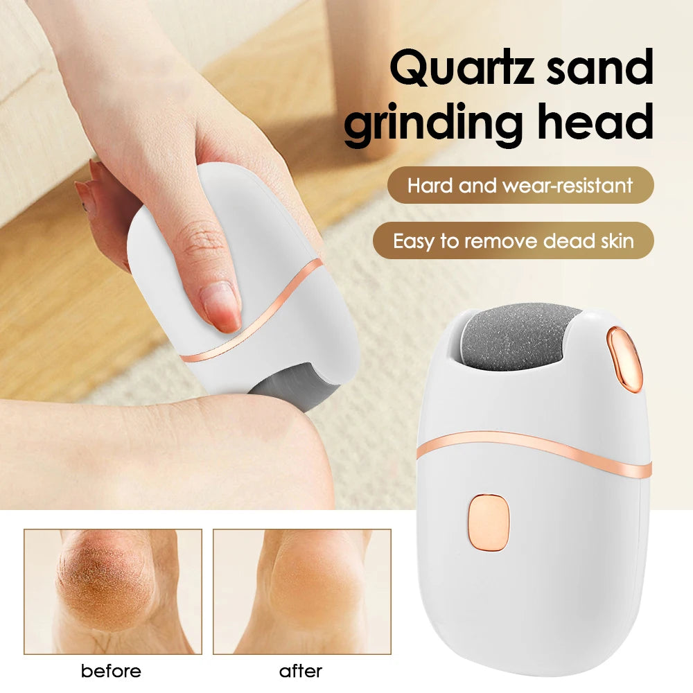 Electric Callus Remover & Repair Cream Kit for Smooth Heels - 3
