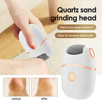 Electric Callus Remover & Repair Cream Kit for Smooth Heels