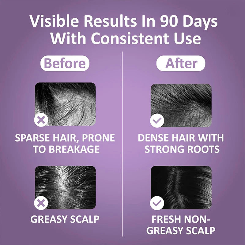 Electric Scalp Massager & Hair Growth Serum Applicator - 15