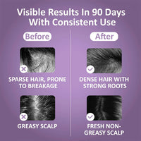Electric Scalp Massager & Hair Growth Serum Applicator