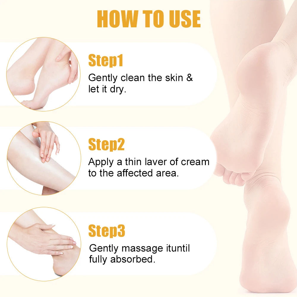60% Urea Moisturizing Cream for Cracked Feet and Dry Skin - 10