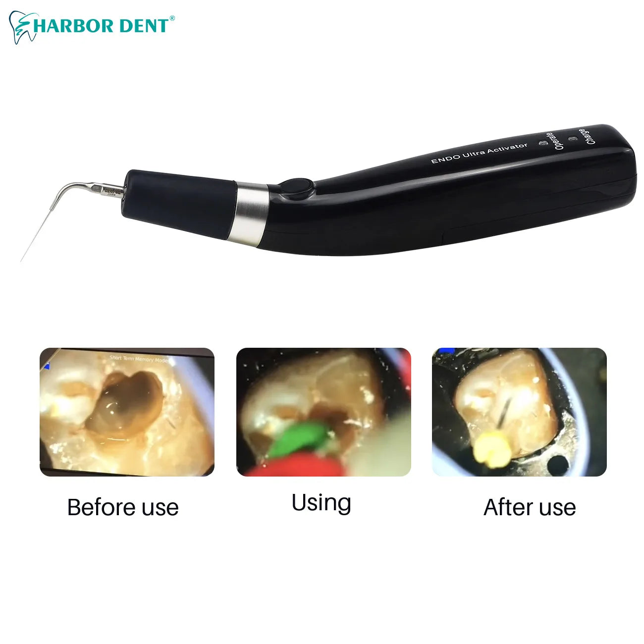 Cordless Ultrasonic Dental Irrigation Activator - 5