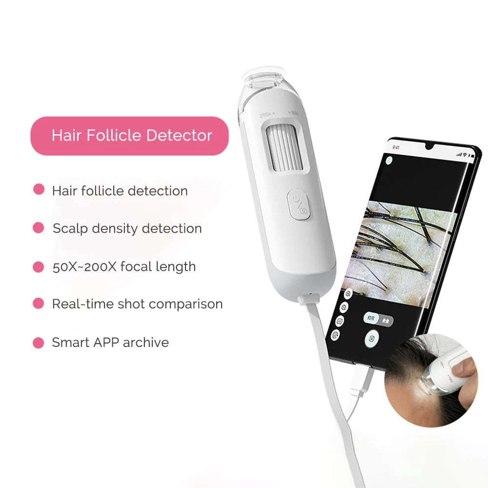 Portable HD Hair Follicle and Scalp Health Analyzer - 10