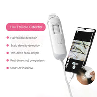 Portable HD Hair Follicle and Scalp Health Analyzer