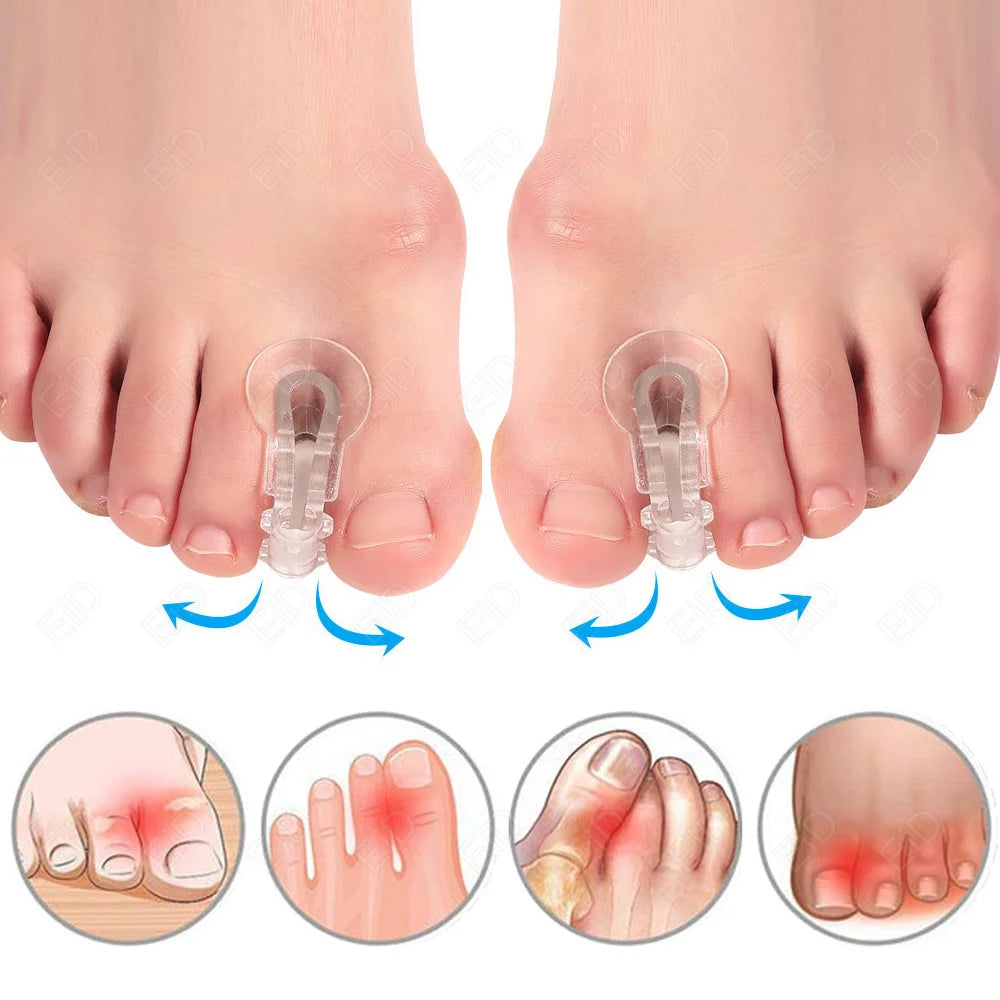Orthopedic Silicone Bunion Corrector and Toe Straightener - 22
