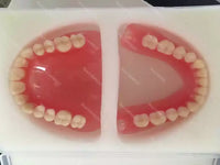 Full Mouth Denture Dental Study Model